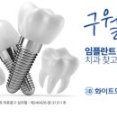 맨하탄치과기공소 네이버블로그