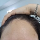 제이셀린뷰티 | 들어는 봤나_스킨플래닝 후기_[제이셀린뷰티]_#대전스킨플래닝#괴정동피부관리 추천