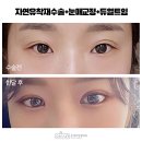온에어성형외과의원 | 강남성형외과유명한곳 결정하는 기준은