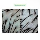 온천장 | 두피관리 필수 올가드림뷰티 온천장점 두피디톡스 후기