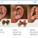 메디컬 보청기 이미지