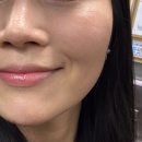 상업용 29 | [남양주 문제성전문] 효과적인 모공타이트닝 관리 후기