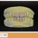 다이안치과기공소 이미지