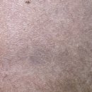 에이치바이오메디칼 이미지