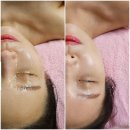 민상3호 | 대구 수성구 체형관리/웰스파 전문/갈바닉 | “민테라피”