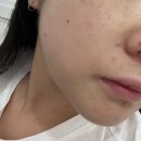 지족동 피부관리:: 토탈뷰티샵 프린세스 보습관리 후기