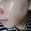 에뉴한서성형외과의원 | 에뉴뷰 홀릭 7 EGF 시카 피부 재생 크림으로 피부를 가꾸어 주세요~