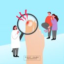 한영정형외과의원 | 팔달구 인계동 발톱무좀이 아프면 내성발톱 치료 교정기로도 가능해요