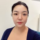 청담동 에스테틱 ‘바이꽁트’ 본래 나의 얼굴 라인 찾아주는 수기빚음 관리