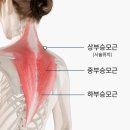 일리치약국 | 없으면 못 사는 인생템 소개 _ 마사지 도구, 밀대, 쌍화탕, 노브라티