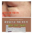 (주)로덱스 | 로덱스 & 리버스 화장품 풀세트 사용하며 쓰는 후기