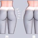 바름운동센터 이미지