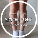 아이레그플러스의원 | 아아레그 평발 안짱다리 교정 2년 후기 (만9세/초4/교정기)