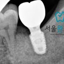 서울완치과 이미지