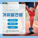 성모척척마취통증의학과의원 | 상계동마취통증의학과, 무릎 안쪽 통증의 원인, &#39;거위발건염&#39;, 예방법은?