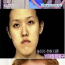 렛미인 이미지