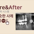인플란트수지치과의원 이미지