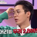 김진헤어라인 | 모발이식 연예인 전후 사진 | 남자 연예인 모발이식 | 여자 연예인 모발이식