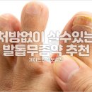 동성약국 | 발톱무좀약 추천, 병원 안 가고 약국에서 바로 살 수 있는 제품은?