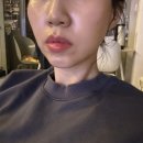 금탑프라자 | 야탑 피부관리ㅣ수리아 에스테틱 동안관리 팔자주름 후기