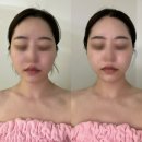 건대 구의역 피부관리 '리바 에스테틱' 미백 윤곽관리 솔직후기