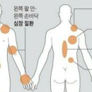 팔 아파서 병원 갔더니 심장질환? 이미지