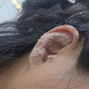 대구 서구 김혜진네일 앤 풋시스 본점 보행 교정과 이어테라피 특별한 관리 후기