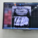 서울플란트치과의원 | 서울 목동 치과, 제일 플란트치과의원 등촌역