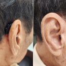 스타키보청기포항점 이미지