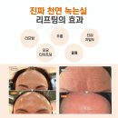 그레이스 미사 피부관리