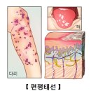태선 티스토리