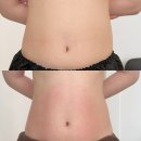 씨유 평택합정중앙로점 | 평택에스테틱 밀도뷰티랩 복부관리 테라노바 케어 후기