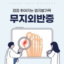 연세베스트병원 | 무지외반증 미카,미타수술(최소침습 교정술)