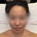 메디빌 | 대구 평리동 타미나다 에스테틱 | 스몰페이스 윤곽관리 후기 신부관리 추천