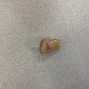 시그니아독일보청기사상센터 이미지