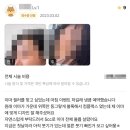 수완지구필러? 수만건 시술한 의료진 노하우 2가지 [대공개]