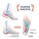 하이힐다이어트(케이엔티상사) | 족저근막염 신발과 다이어트 신발로 지간신경종과...치료.완치.예방.후기..덤으로 퇴행성 허리디스크...