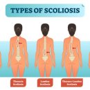 팔머메디스포츠 이미지