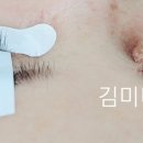 김미더스킨