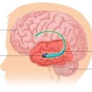 기억 중추 해마 위축만으로도 인지기능 저하 이미지