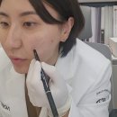 복피부과의원 | 현직 피부과 의사의 엘라비엘리투오 솔직 시술후기