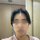 [내돈내산] 대전 미탐의원, IPL , 루비레이저 효과 통증 관리법 후기글