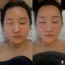 하얀피부 | 강서구 얼굴경락으로 이중턱 탈출 강서하얀피부에서 받은 첫 윤곽관리 후기