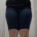 리라피부과의원 | 삼성역피부과 효과 좋은 허벅지지방분해주사 라라주사+트리플바디 시술 받고 온 후기(가격, 통증,전후)