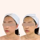 둔산중로-21 | 대전 윤곽관리 잘하는 곳 | 둔산동 신의 손 신부관리 아로뮤에스테틱 후기