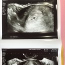 아미산부인과의원 네이버블로그