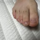 뷰티온네일 | 수원광교 이의동네일 아주대네일샵 내성발톱 이중발톱 집중관리 뷰티온더데이 추천후기!