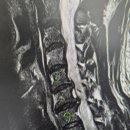 반듯한신경외과의원 | 경추디스크? 이 방법으로 수술까지 막을 수 있습니다
