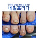 프리다네일