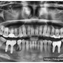 가온치과기공소 이미지